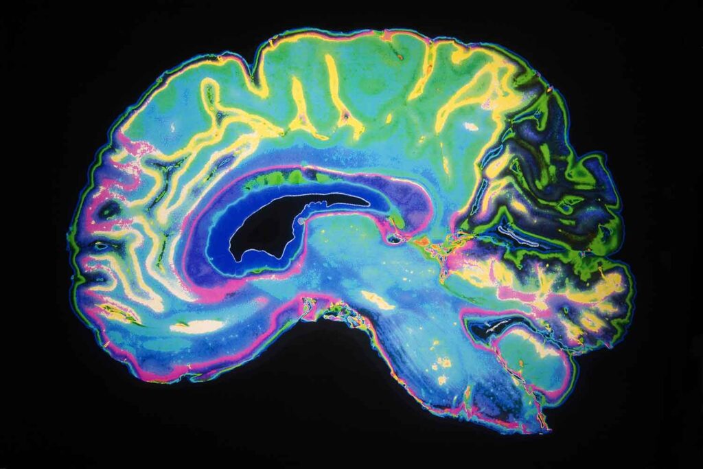 opiate receptors