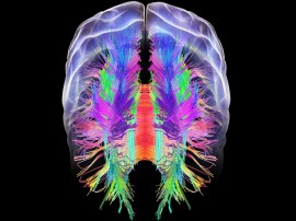 Waismann Method on Effects of Opiate Dependence on Learning and Memory Pathways in the Brain Waismann Method on Effects of Opiate Dependence on Learning and Memory Pathways in the Brain