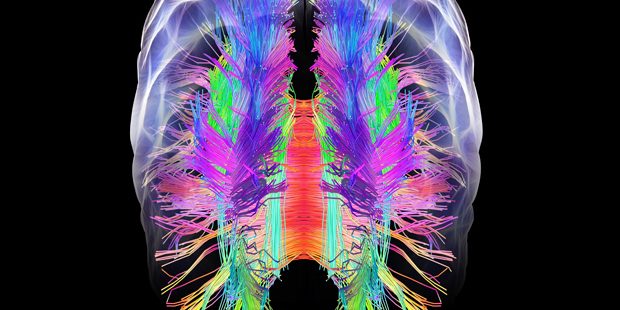 3D xray of brain with various colors mapping nervous system