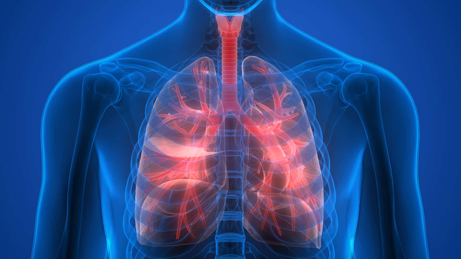 x-ray of chest showing lungs with red indicating inflamation. Demonstrates the link between opioid use and pulmonary conditions