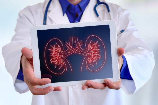 doctor holding digital image of kidneys to illustrate how opioids can cause kidney damage