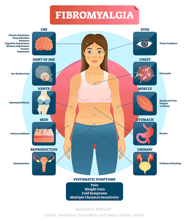 Fibromyalgia vector illustration