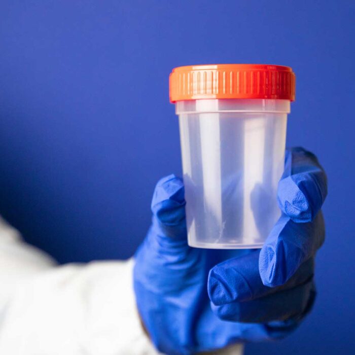 How Long Does Fentanyl Stay in Your System?